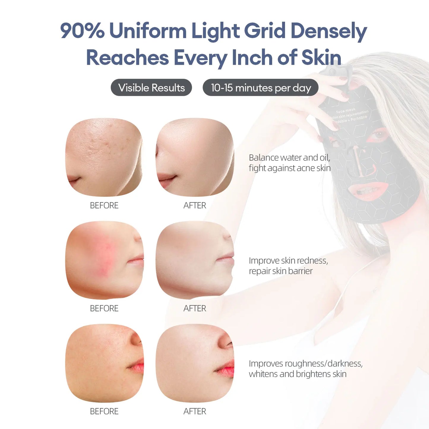 Foreverlily Photon Silicone LED Face Mask For Skin Rejuvenation